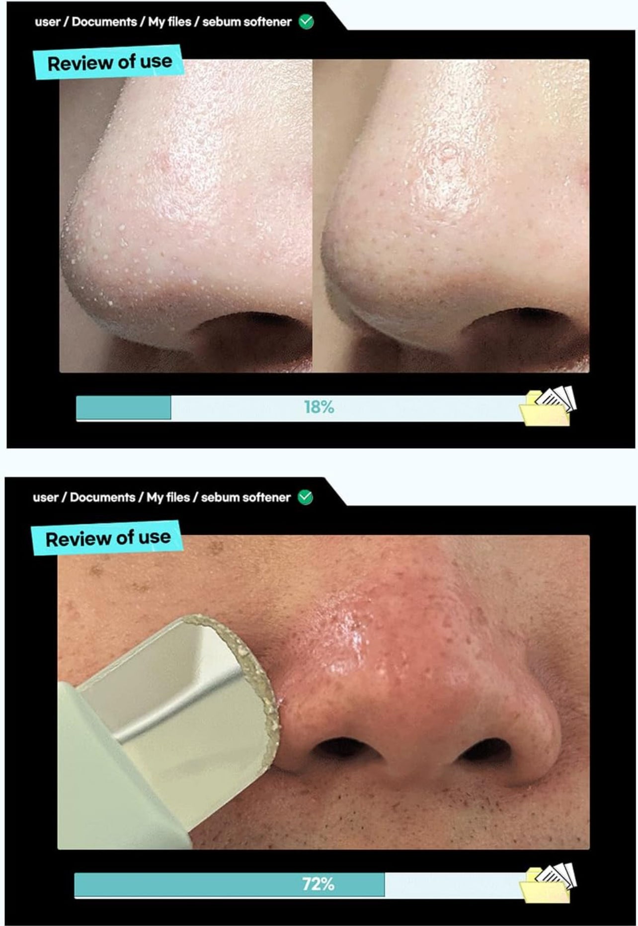 ILSO Super Melting SEBUM Softener + 1/3 Saving Cotton Pad ilso Skincare ilso