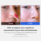 Medicube Zero Pore Pads 2.0 medicube Skincare medicube