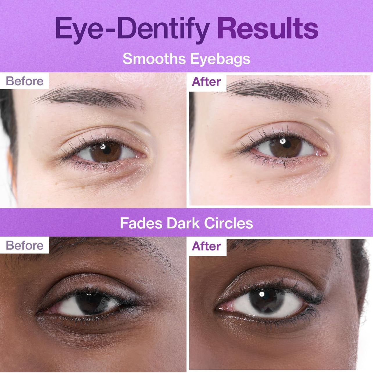 numbuzin No.9 Eye Patches NUMBUZIN Skincare NUMBUZIN