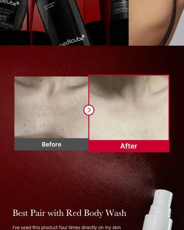 medicube - Red Acne Body Peeling Shot - ISLA 
