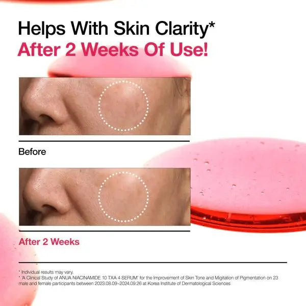 Anua Niacinamide 10% + TXA 4% Serum - ISLA 